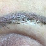 Eyebrow Microblading Before & After Patient #11768